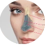 rhinoplasty-nose-surgery in jaipur|cosmo care