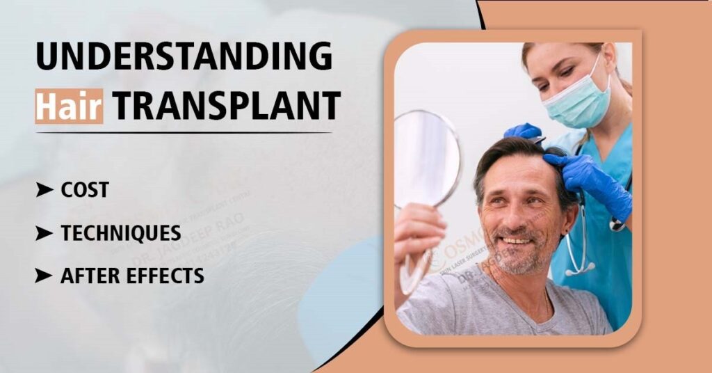 Hair Transplant Cost