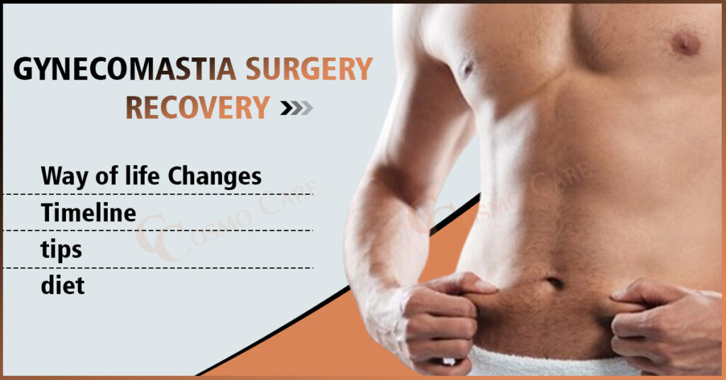 Gynecomastia Surgery