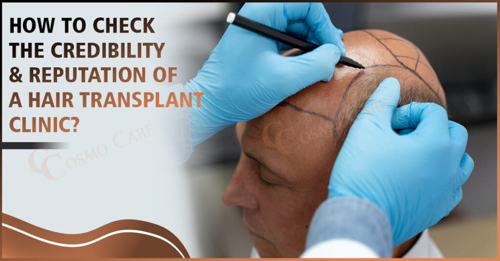 Best Hair Transplant Clinic