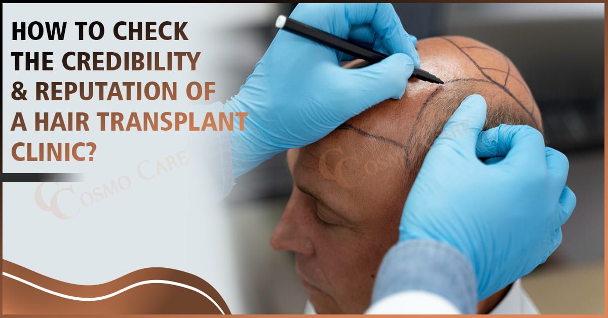 Best Hair Transplant Clinic