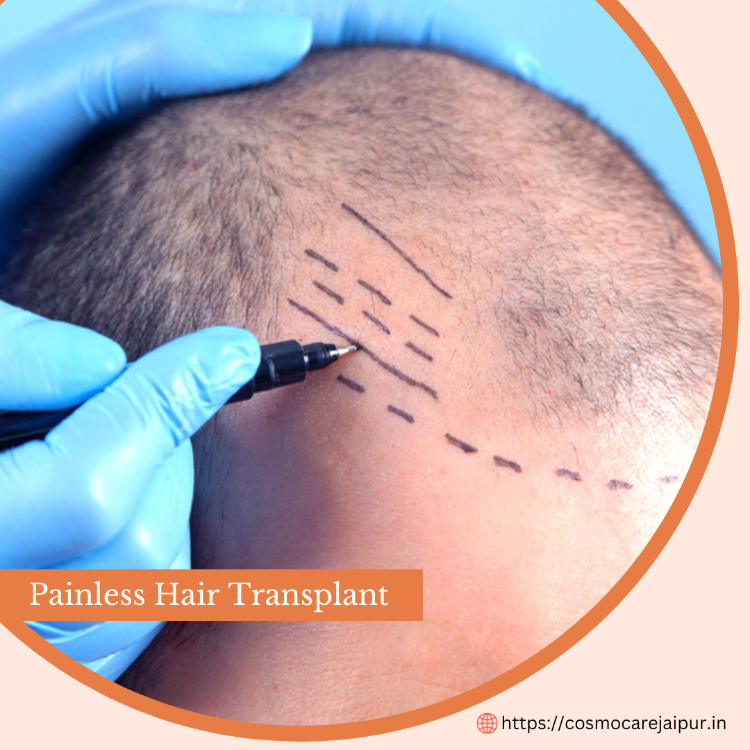 Best Hair Transplant in  Jaipur