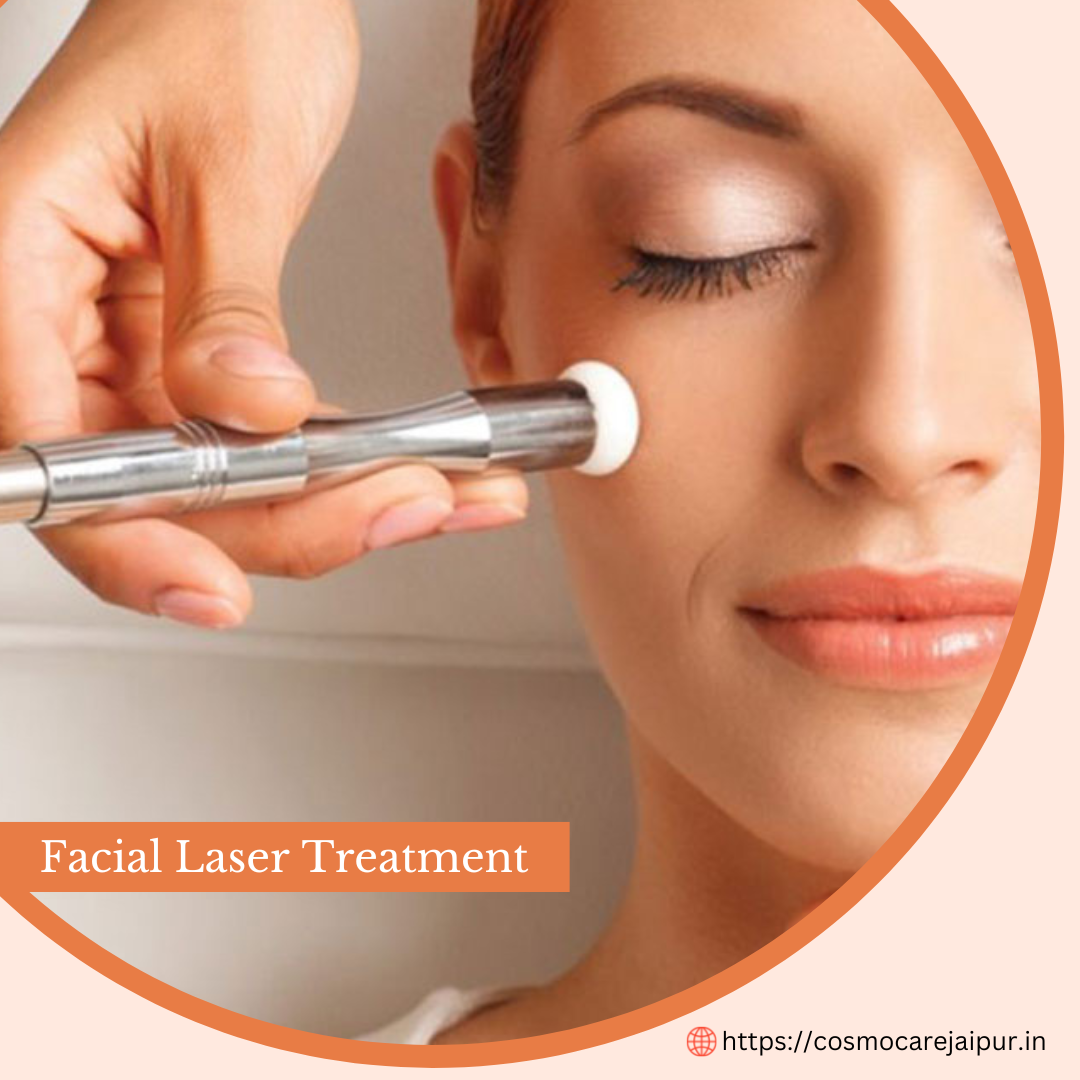 best facial laser treatments